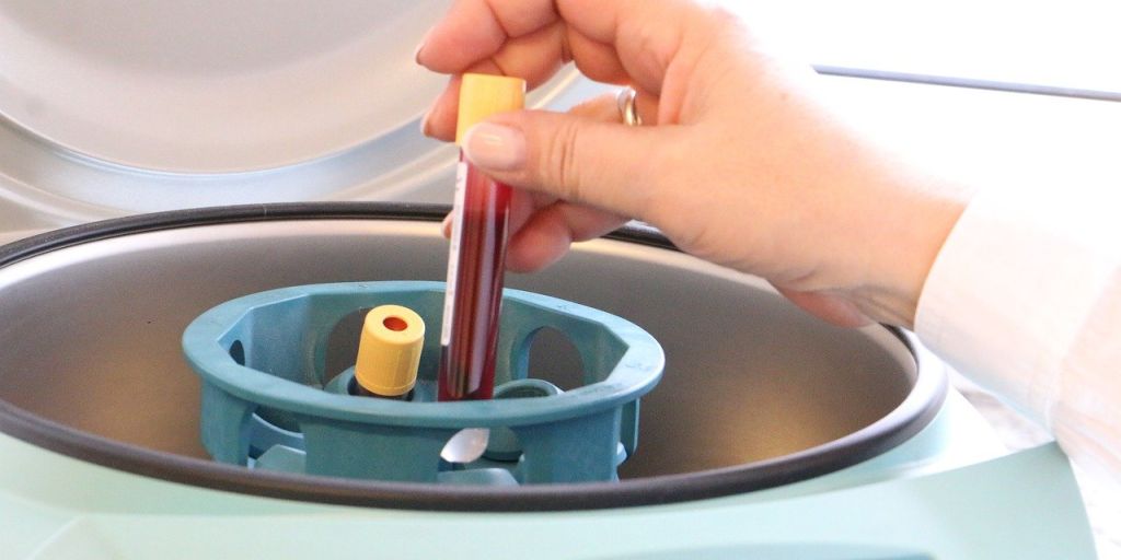 blutuntersuchung hund blutuntersuchung katze felmo