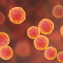 Bakterielle Infektionen können zu Analdrüsenverstopfung und Entzündungen führen