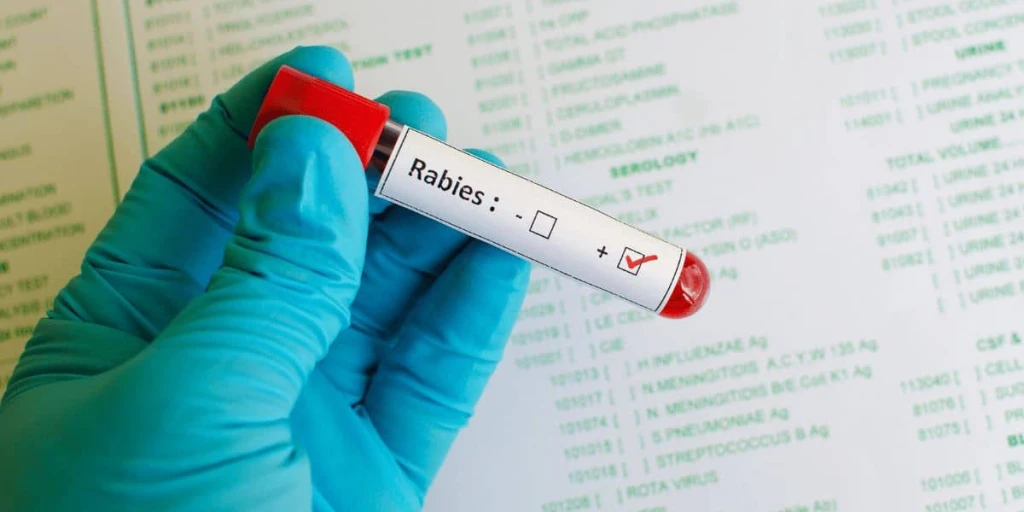 Eine Probe für die Testung auf Tollwut. Die Bezeichnung Rabies ist englisch für Tollwut.