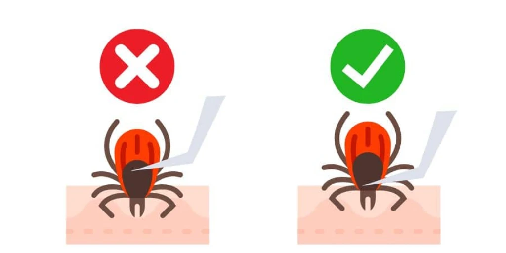 Zecken richtig entfernen